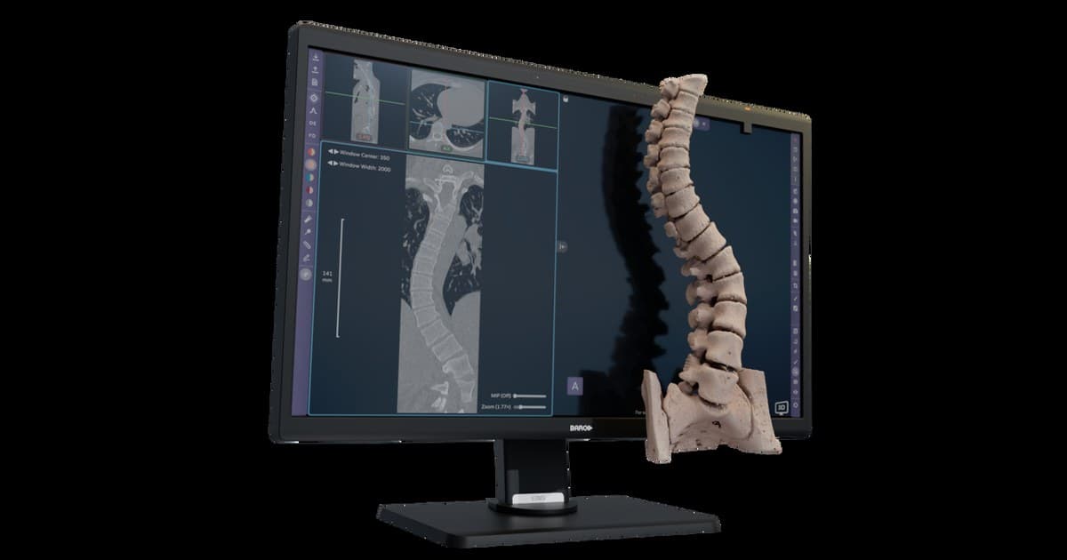Avatar Medical Receives CE Marking for Avatar Medical Vision, the First Software CE-Marked for Use with a Glasses-Free 3D Medical Display